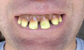 Funny-Yellow-Teeth-Image.jpg