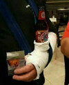 escayola-brazo-botella-cerveza.jpg escayola-brazo-botella-cerveza.jpg