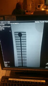 Strat Neck xray.jpg