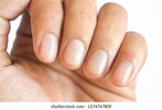 small-lunulae-halfmoons-fingernails-longitudinal-260nw-1574747809.jpg