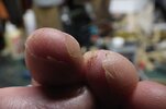crappy fingertips.jpg